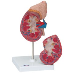 Ledvinka s nadledvinou